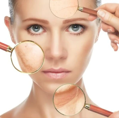 reposição de colágeno facial