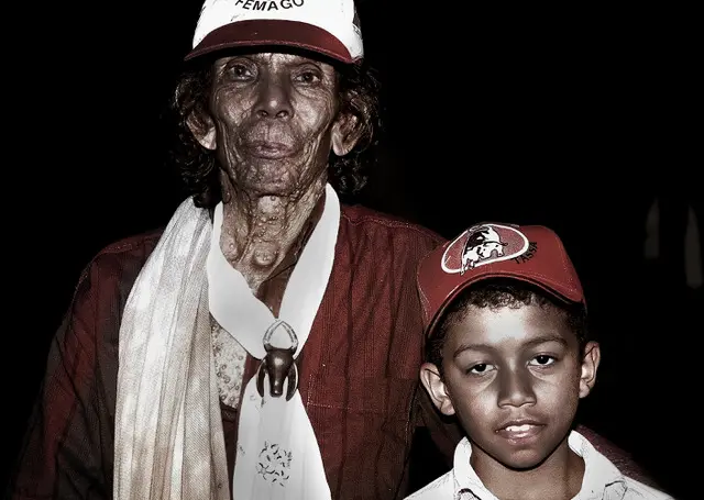 “Sorrisos e Cicatrizes – Retratos de uma Realidade Invisível”, de Rosary Esteves (2)