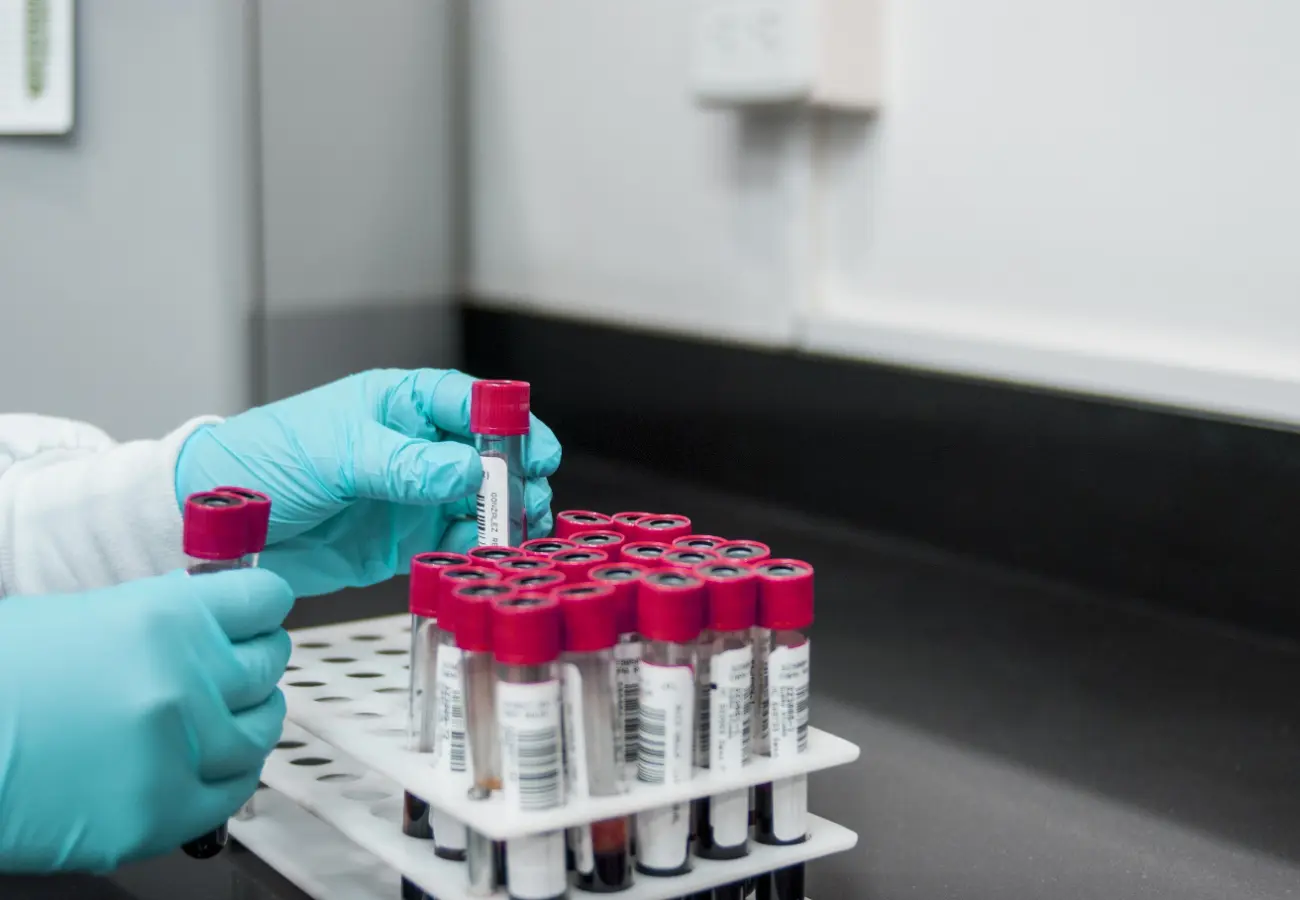 Pesquisas brasileiras avançam no diagnóstico de Alzheimer