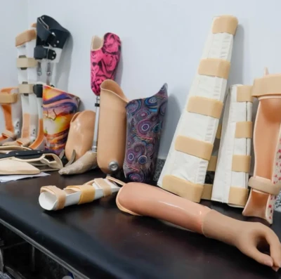 Crer fabrica próteses com alta tecnologia (Foto: Klysman Prado)