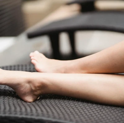 Varizes em mulheres podem ir além da estética e aumentar risco de trombose