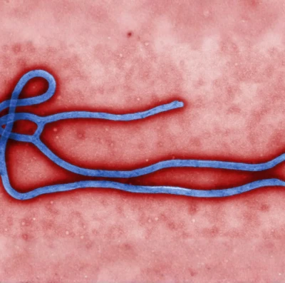 Ebola o que é a doença, como é transmitida e qual é a situação em 2026