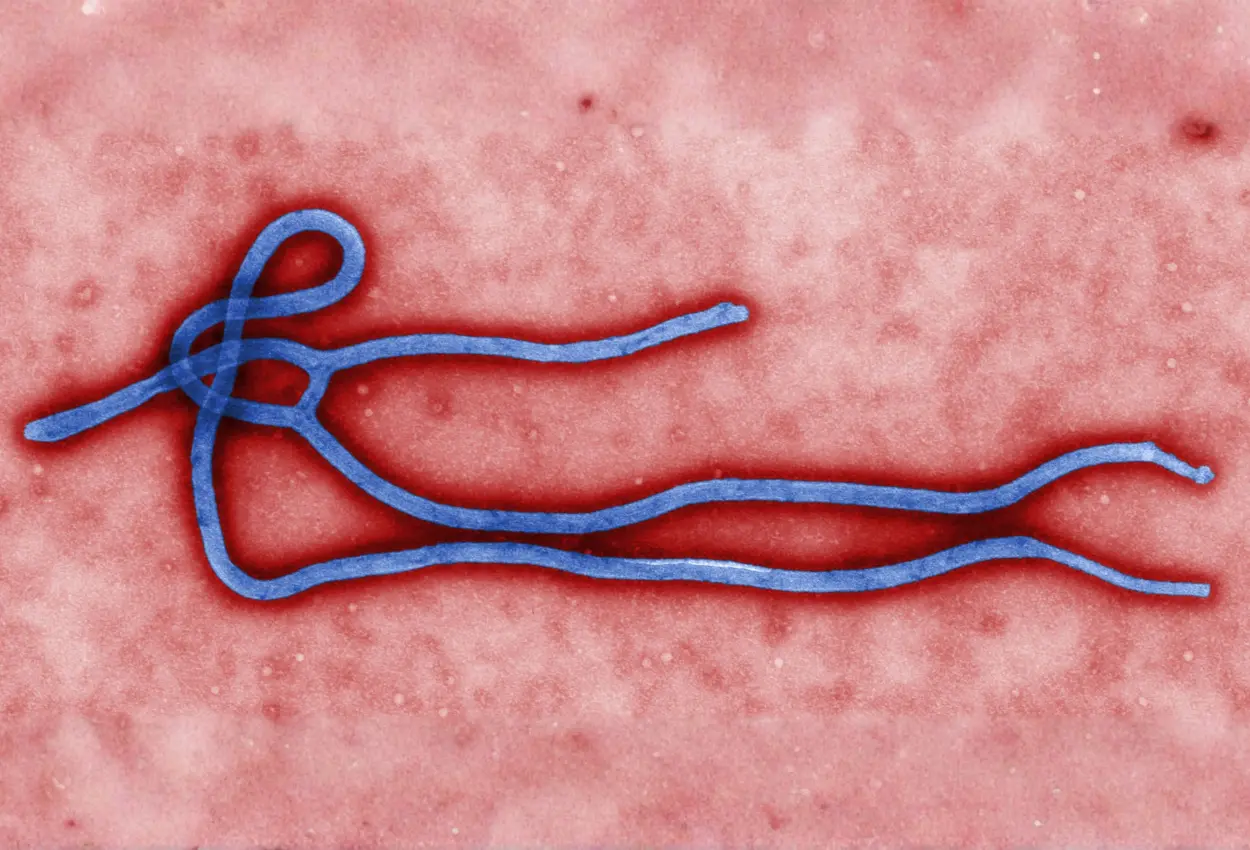 Ebola o que é a doença, como é transmitida e qual é a situação em 2026