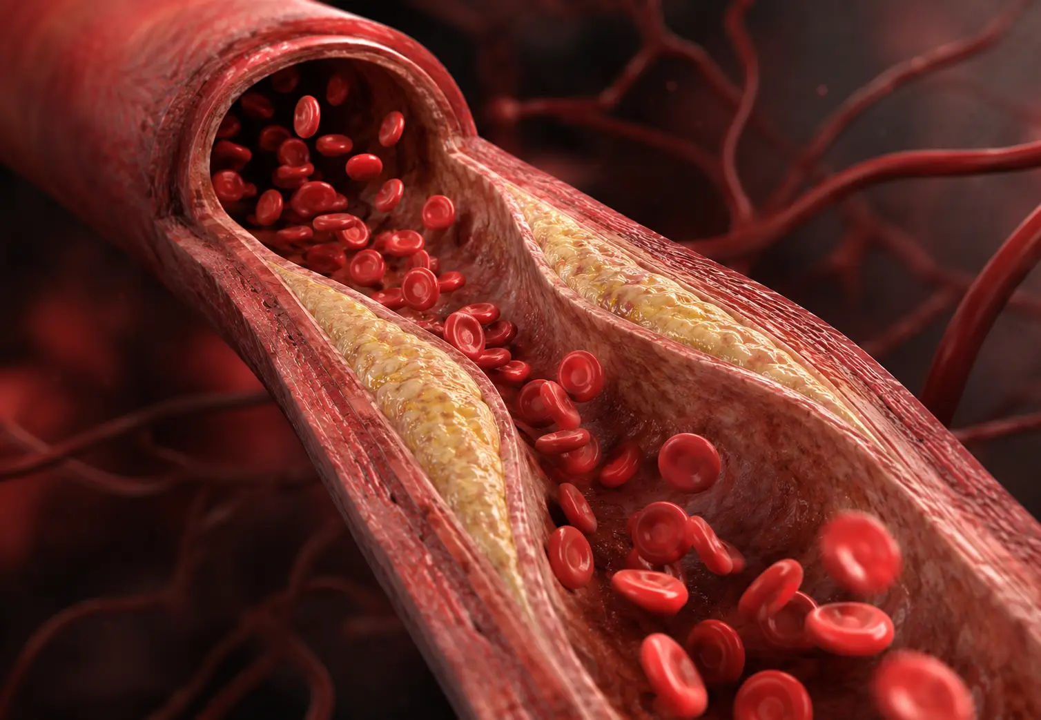 Terapia genética reduz colesterol LDL em até 62% com dose única, aponta estudo