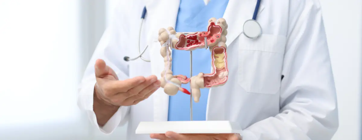 creatina e inflamação intestinal